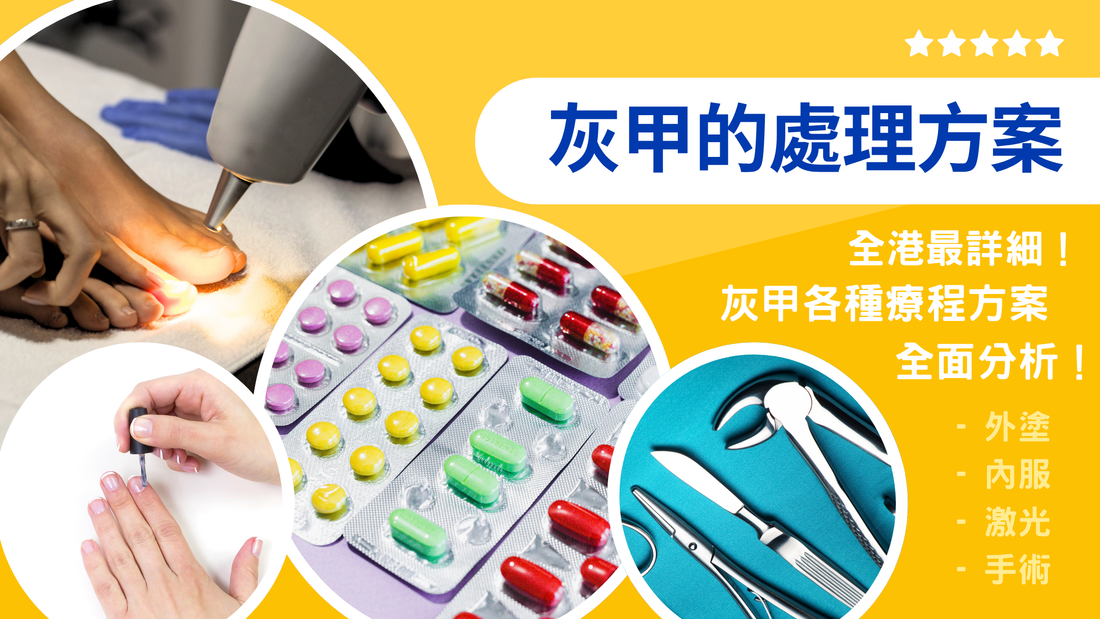 灰甲的治療方案