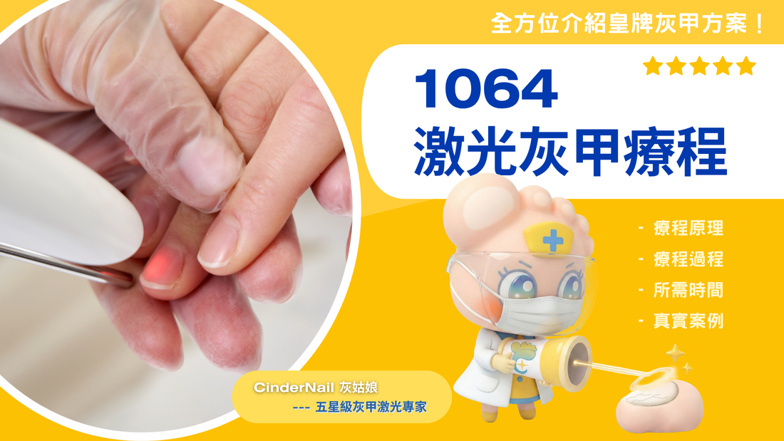 1064激光灰甲療程