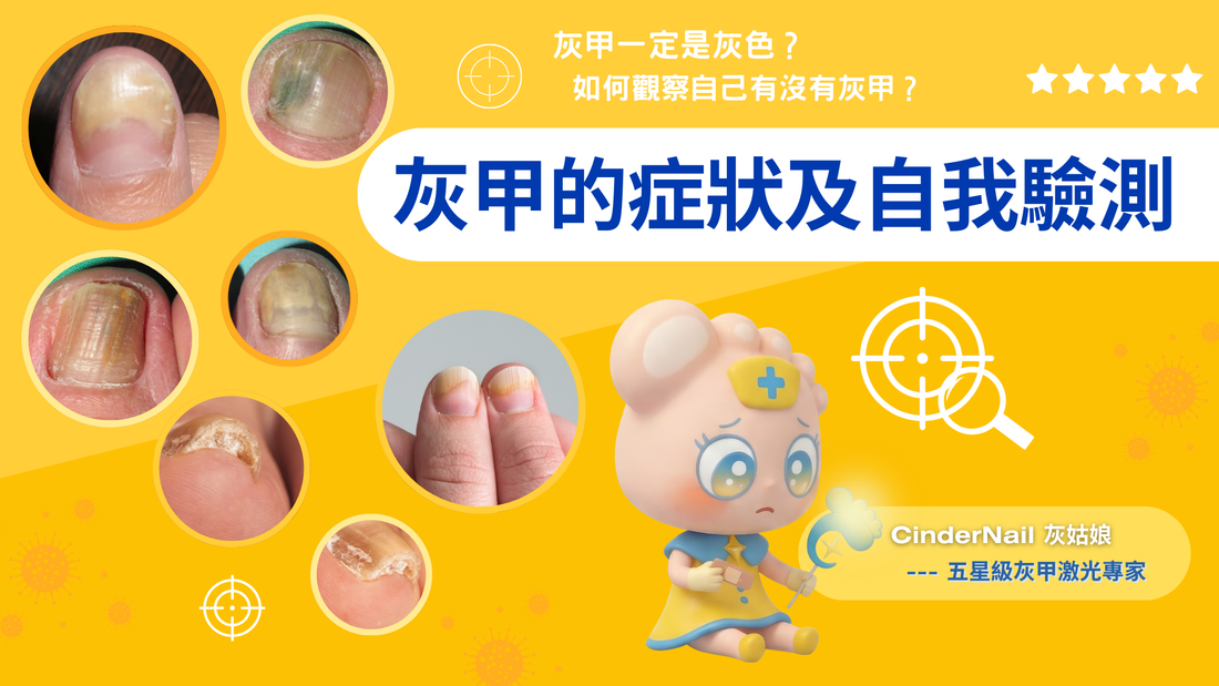 灰甲的症狀及自我驗測